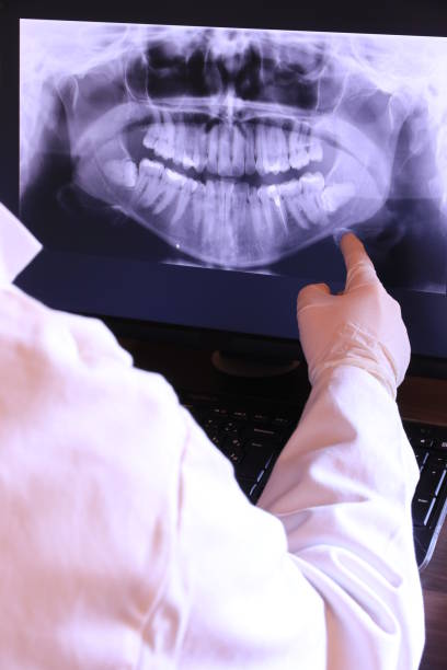 Best Emergency Dental Extractions in Mason, MI